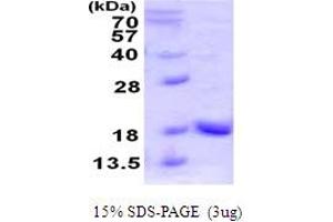 SDS-PAGE (SDS) image for Ubiquitin-Like 4A (UBL4A) (AA 1-157) protein (His tag) (ABIN667680)