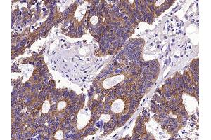 Immunohistochemistry (Paraffin-embedded Sections) (IHC (p)) image for anti-Keratin 1 (KRT1) (AA 141-240) antibody (ABIN733343)
