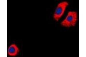 Immunofluorescent analysis of CYSLTR1 staining in Jurkat cells. (CysLTR1 antibody)