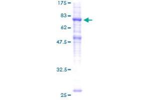 SLC39A7 Protein (AA 32-469) (GST tag)