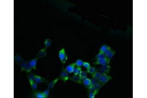 Immunofluorescent analysis of 293 cells using ABIN7170098 at dilution of 1:100 and Alexa Fluor 488-congugated AffiniPure Goat Anti-Rabbit IgG(H+L) (SLC13A4 antibody  (AA 134-273))