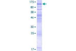 Solute Carrier Family 7 (Cationic Amino Acid Transporter, Y+ System), Member 14 (SLC7A14) (AA 1-737) protein (GST tag)