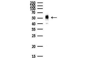 Western blot analysis of lysates from HepG2 cells(heat-shock,45 min treatment), using C Antibody at 1/1000 dilution.