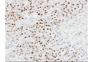 Immunohistochemistry (IHC) image for anti-Tumor Protein P63 (TP63) antibody (ABIN2855394)