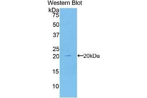 Detection of Recombinant CDKN2A, Human using Polyclonal Antibody to Cyclin Dependent Kinase Inhibitor 2A (CDKN2A) (CDKN2A antibody  (AA 8-156))