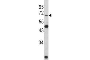 Western blot analysis of Lamin B2 antibody and Y79 lysate (Lamin B2 antibody  (AA 476-504))