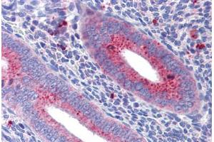 Uterus: Formalin-Fixed, Paraffin-Embedded (FFPE) (MFN1 antibody  (AA 745-756))