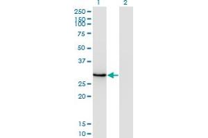Western Blot analysis of DLX1 expression in transfected 293T cell line by DLX1 monoclonal antibody (M14), clone 4H7. (DLX1 antibody  (AA 181-254))
