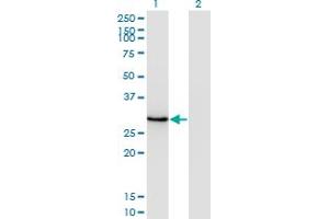 Western Blot analysis of DLX1 expression in transfected 293T cell line by DLX1 monoclonal antibody (M14), clone 4H7. (DLX1 antibody  (AA 181-254))