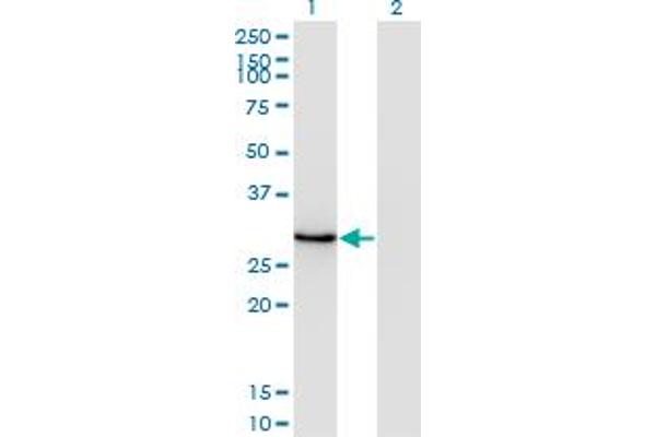 DLX1 Antikörper  (AA 181-254)