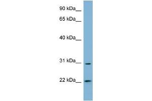 WB Suggested Anti-HSD17B14 Antibody Titration: 0. (HSD17B14 antibody  (N-Term))