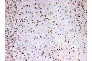 Immunohistochemistry (IHC) image for anti-Mediator Complex Subunit 4 (MED4) (AA 27-140) antibody (ABIN5519029)