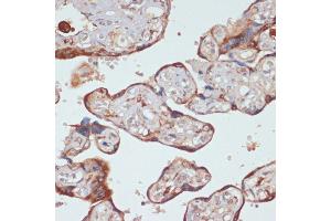 Immunohistochemistry (IHC) image for anti-Caspase 9, Apoptosis-Related Cysteine Peptidase (CASP9) (AA 1-98) antibody (ABIN6137975)