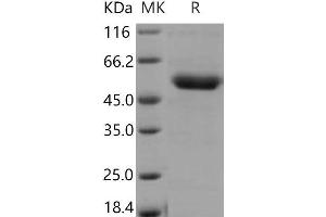 Western Blotting (WB) image for Ectonucleoside Triphosphate diphosphohydrolase 1 (ENTPD1) (Active) protein (His tag) (ABIN7195466) (CD39 Protein (His tag))