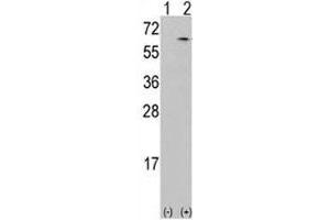 Western blot analysis of CAMKK antibody and 293 cell lysate either nontransfected (Lane 1) or transiently transfected with the CAMKK1 gene (2). (CAMKK1 antibody  (AA 86-121))