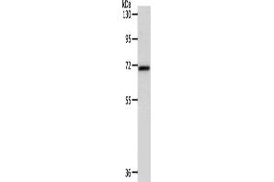 Western Blotting (WB) image for anti-SRY (Sex Determining Region Y)-Box 13 (SOX13) antibody (ABIN2426908) (SOX13 antibody)