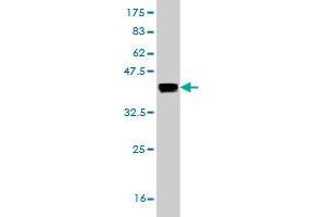 Western Blot detection against Immunogen (36. (CRYM antibody  (AA 215-314))