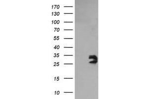 Image no. 1 for anti-Glioblastoma Amplified Sequence (GBAS) antibody (ABIN1498394) (GBAS antibody)