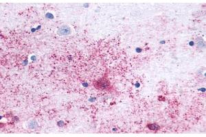 Anti-MAS1 antibody  ABIN1049039 IHC staining of human brain, neurons and glia. (MAS1 antibody  (Cytoplasmic Domain))