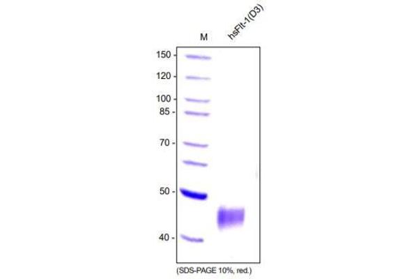 FLT1 Protein (glycosylated, Monomer, Soluble)