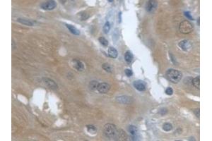 Detection of TGFa in Human Esophagus Tissue using Monoclonal Antibody to Transforming Growth Factor Alpha (TGFa) (TGFA antibody  (AA 24-98))