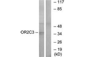 Western blot analysis of extracts from COLO cells, using OR2C3 Antibody. (OR2C3 antibody  (AA 231-280))