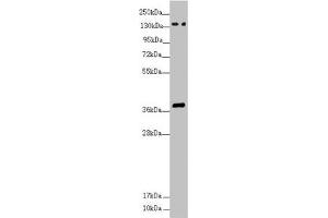 Western blot All lanes: SFI1 antibody at 4. (SFI1 antibody  (AA 1003-1242))