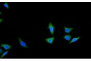 Immunofluorescence (IF) image for anti-Keratin 18 (KRT18) (AA 238-396) antibody (ABIN7426868)