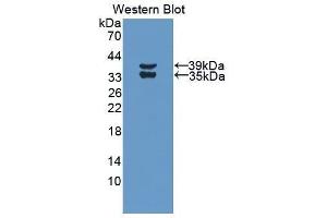 Western Blotting (WB) image for anti-Complement Fragment 3a (C3a) (AA 671-748) antibody (ABIN3208724) (C3a antibody  (AA 671-748))