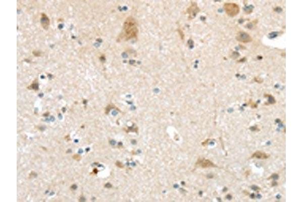 VSIG1 antibody