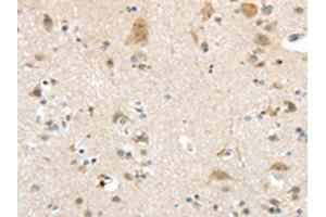The image on the left is immunohistochemistry of paraffin-embedded Human brain tissue using ABIN7193032(VSIG10 Antibody) at dilution 1/45, on the right is treated with synthetic peptide. (VSIG1 antibody)
