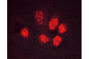 ABIN6267495 staining Hela cells by ICC/IF. (PPARG antibody  (pSer112))