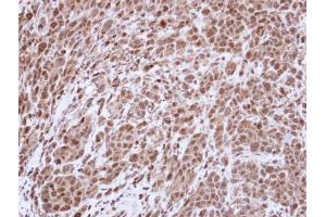 IHC-P Image Immunohistochemical analysis of paraffin-embedded SAS Xenograft , using Topoisomerase II alpha , antibody at 1:500 dilution. (Topoisomerase II alpha antibody  (C-Term))