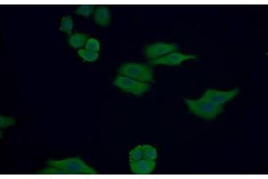 Detection of Trx in Human MCF7 cell using Polyclonal Antibody to Thioredoxin (Trx) (TXN antibody  (AA 1-105))