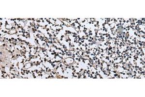 Immunohistochemistry of paraffin-embedded Human tonsil tissue using ZFP36 Polyclonal Antibody at dilution of 1:40(x200) (ZFP36 antibody)
