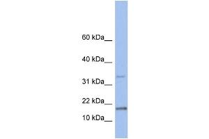 WB Suggested Anti-TCL1A Antibody Titration: 0. (TCL1A antibody  (N-Term))