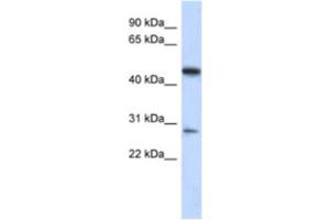 Western Blotting (WB) image for anti-Chromosome 13 Open Reading Frame 31 (C13orf31) antibody (ABIN2463927) (LACC1 antibody)