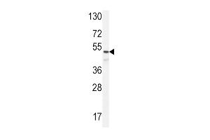 ANGPT1 Antibody (C-term) (ABIN654409 and ABIN2844148) western blot analysis in NCI- cell line lysates (35 μg/lane). (Angiopoietin 1 antibody  (C-Term))