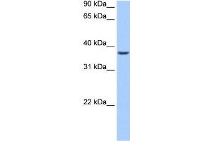 WB Suggested Anti-ALKBH8 Antibody Titration:  0.