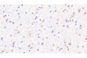 Detection of IBA1 in Mouse Cerebrum Tissue using Polyclonal Antibody to Ionized Calcium-binding Adapter Molecule 1 (IBA1) (Iba1 antibody  (AA 35-102))