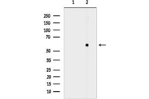 Western blot analysis of lysates from Rat liver, using Cytochrome P450 2W1 Antibody.