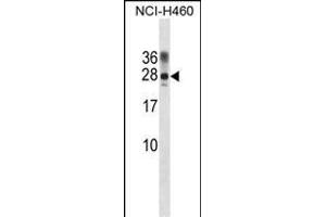 RAT Ppp1r2 Antibody (Center) (ABIN1881680 and ABIN2839055) western blot analysis in NCI- cell line lysates (35 μg/lane). (PPP1R2 antibody  (AA 49-77))