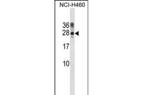 PPP1R2 Antikörper  (AA 49-77)