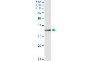 Immunoprecipitation of NAT1 transfected lysate using anti-NAT1 MaxPab rabbit polyclonal antibody and Protein A Magnetic Bead , and immunoblotted with NAT1 purified MaxPab mouse polyclonal antibody (B01P) . (NAT1 antibody  (AA 1-290))