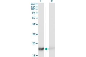Western Blot analysis of TSC22D1 expression in transfected 293T cell line by TSC22D1 monoclonal antibody (M06), clone 2E2. (TSC22D1 antibody  (AA 1-144))