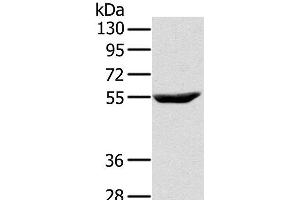 Western Blot analysis of Raji cell using CYTH1 Polyclonal Antibody at dilution of 1:200