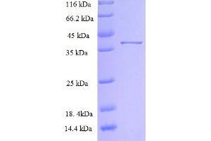 SDS-PAGE (SDS) image for Solute Carrier Family 39 (Zinc Transporter), Member 13 (SLC39A13) (AA 130-233) protein (His-GST) (ABIN5711359)