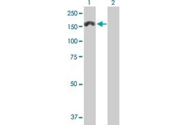 MTMR3 antibody  (AA 1-1198)