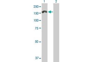 Western Blot analysis of MTMR3 expression in transfected 293T cell line by MTMR3 MaxPab polyclonal antibody.