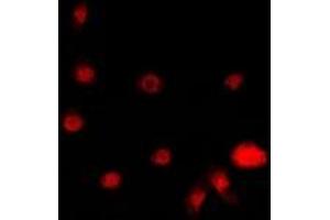 Immunofluorescent analysis of STK19 staining in A549 cells. (STK19 antibody)